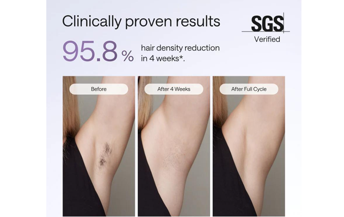 Natural-Looking Results with Modern Facial Hair Removal